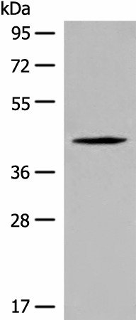 Western blot analysis of Jurkat cell lysate  using QTRT1 Polyclonal Antibody at dilution of 1:450