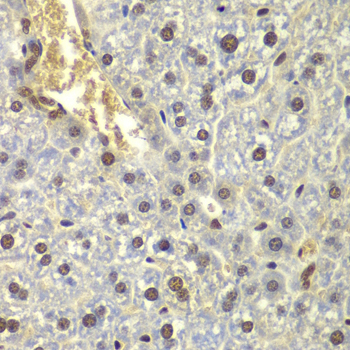 Immunohistochemistry of paraffin-embedded mouse liver using RPL5 Polyclonal Antibody at dilution of 1:200 (40x lens).Perform microwave antigen retrieval with 10 mM PBS buffer pH 7.2 before commencing with IHC staining protocol.