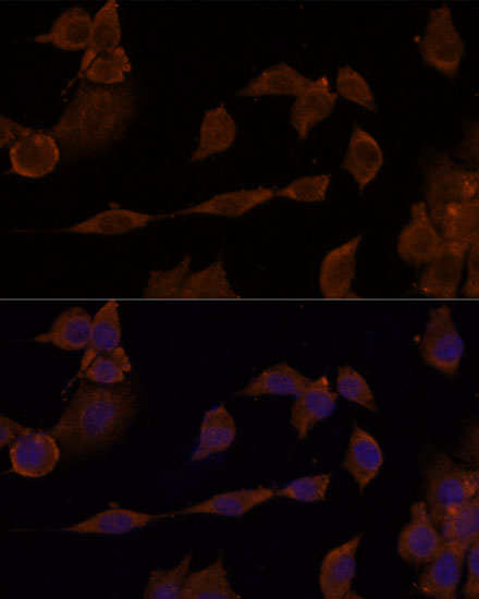 Immunofluorescence analysis of NIH/3T3 cells using GNA11 Polyclonal Antibody at dilution of 1:100. Blue: DAPI for nuclear staining.