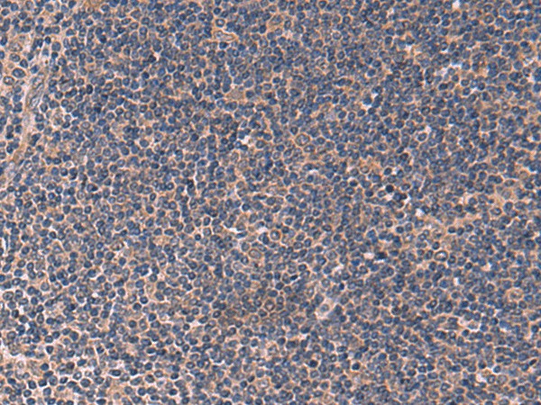 Immunohistochemistry of paraffin-embedded Human tonsil tissue  using ITPR2 Polyclonal Antibody at dilution of 1:60(?200)