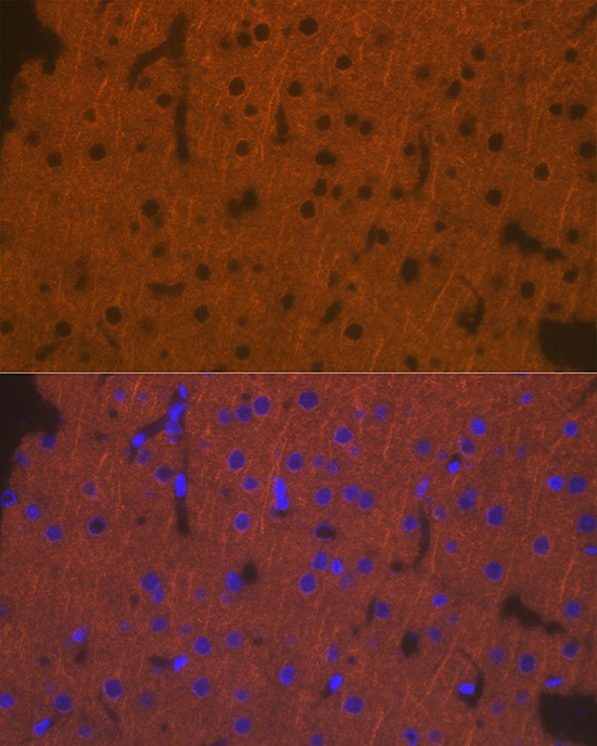 Immunofluorescence analysis of rat brain cells using DCAMKL1/DCLK1 Polyclonal Antibody at dilution of 1:100 (40x lens). Blue: DAPI for nuclear staining.