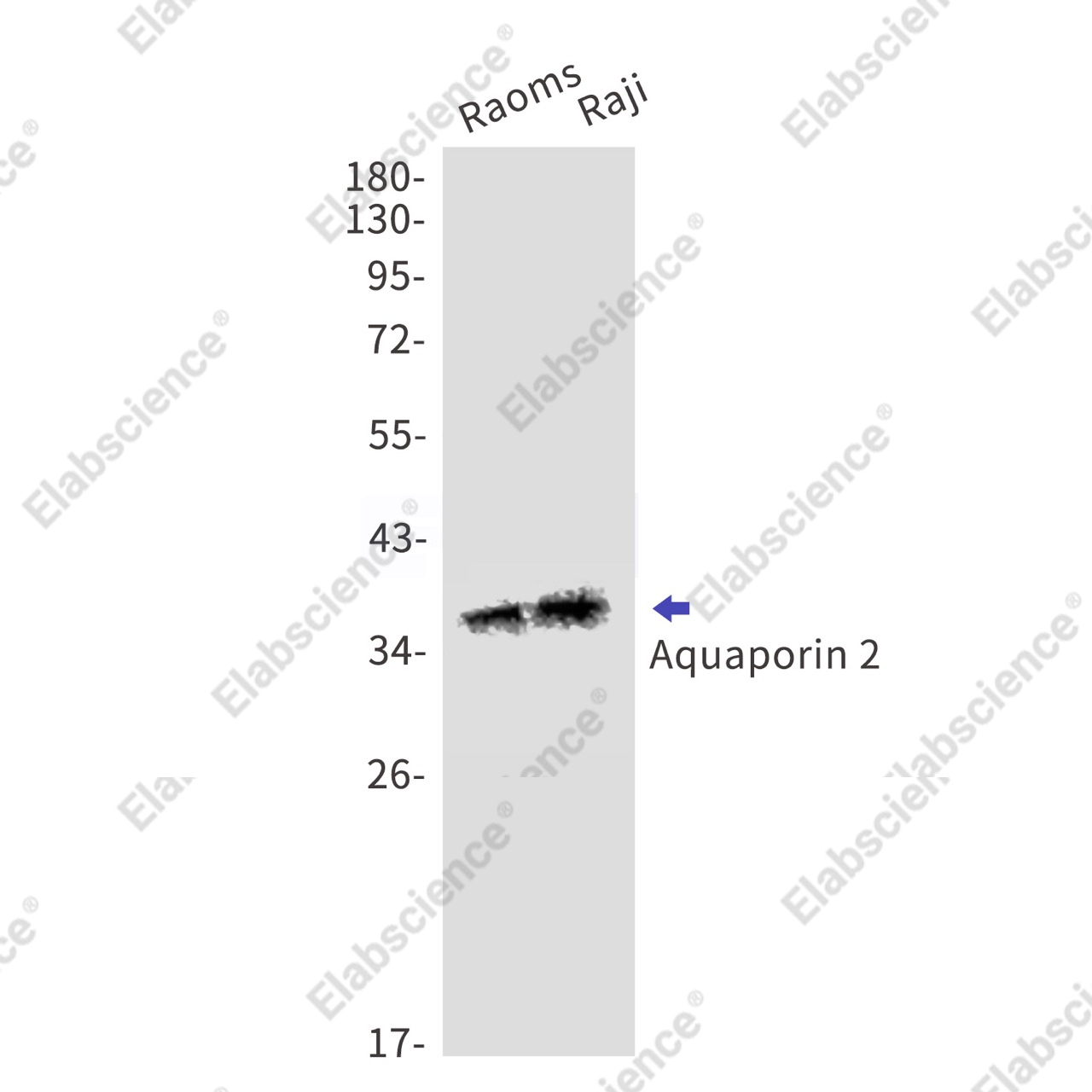 Recombinant Aquaporin 2 Monoclonal Antibody - 1