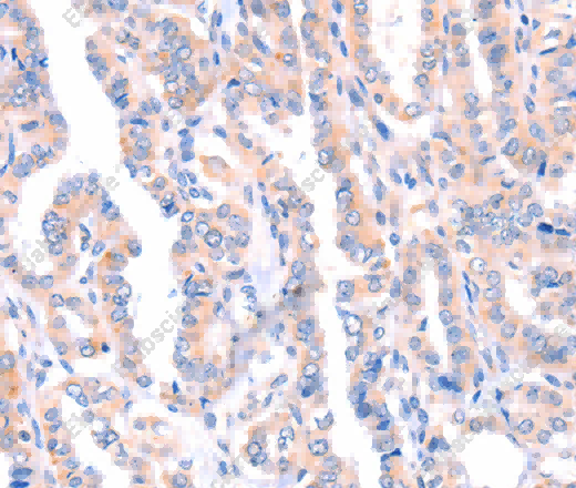 AMPD1 Polyclonal Antibody - 3