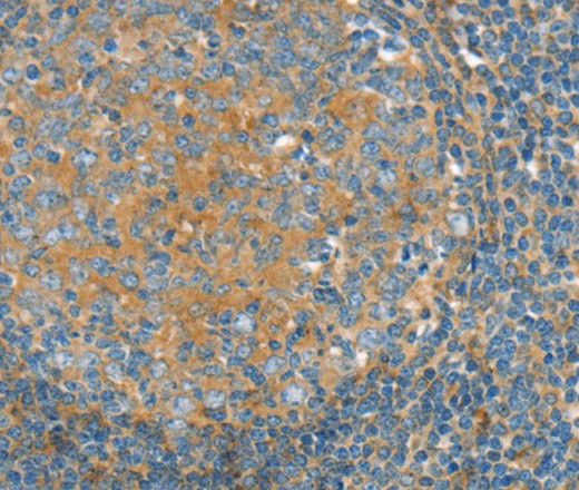 Immunohistochemistry of paraffin-embedded Human tonsil using SNX3 Polyclonal Antibody at dilution of 1:30