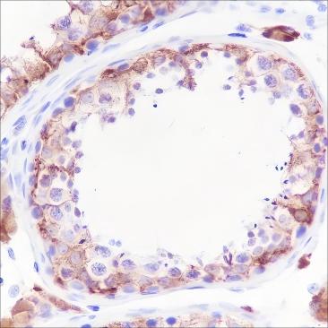 Recombinant Inhibin alpha Monoclonal Antibody - 3