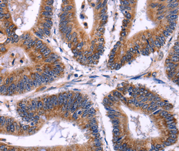 SIGLEC5 Polyclonal Antibody - 3