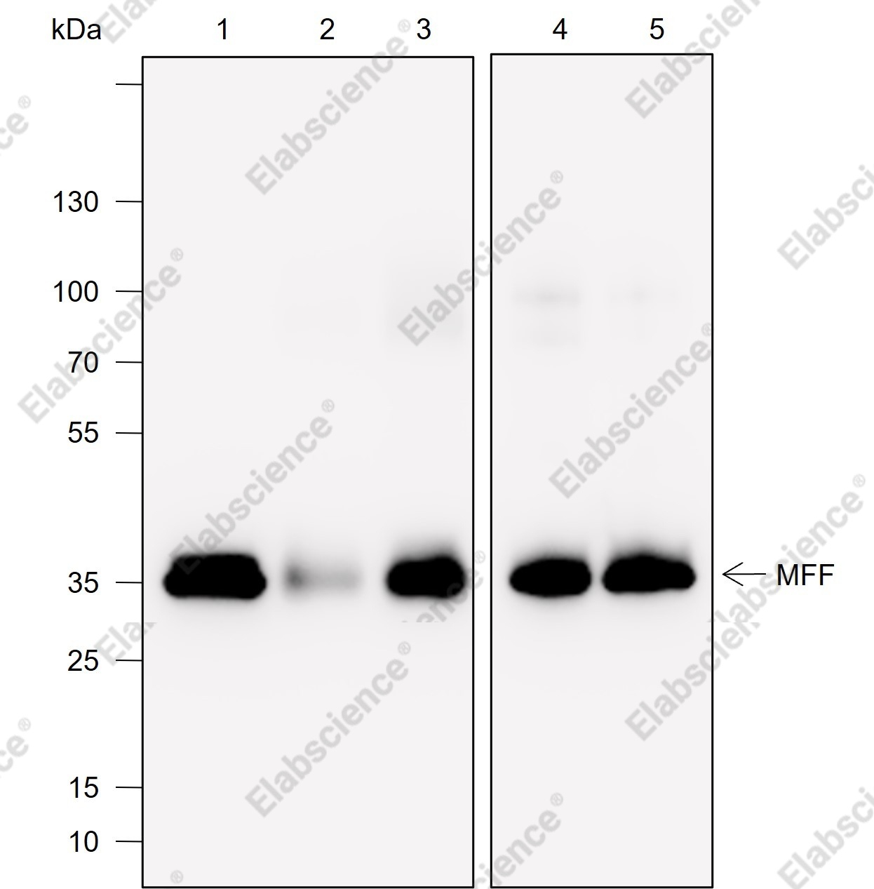 Recombinant MFF Monoclonal Antibody - 1