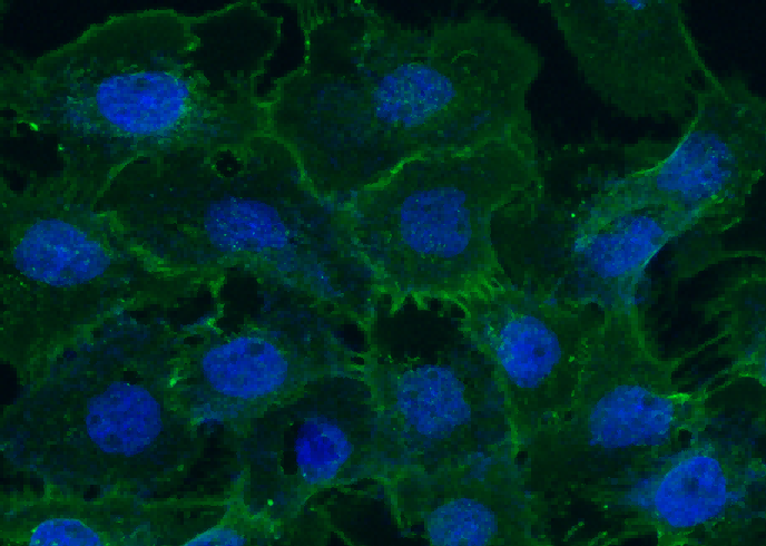 Coagulation Factor III/Tissue Factor/CD142 Monoclonal Antibody - small - 2