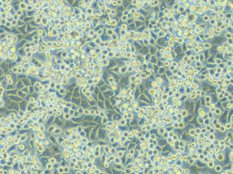 NCI-H2122 Cell Complete Medium - 4