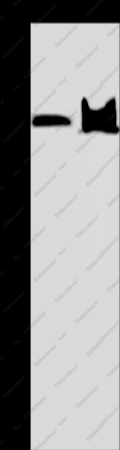 KDM4C Polyclonal Antibody - 1