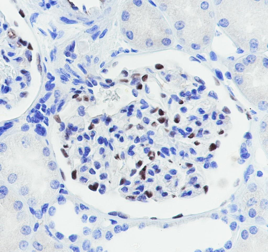 Recombinant WT1 Monoclonal Antibody - 3
