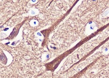 Recombinant beta II Tubulin Monoclonal Antibody-searchlist-2
