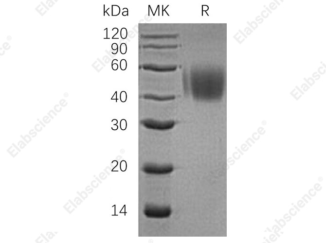 Recombinant Human CD150/SLAMF1 Protein (His Tag) - 1