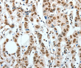 BNIP1 Polyclonal Antibody - 3