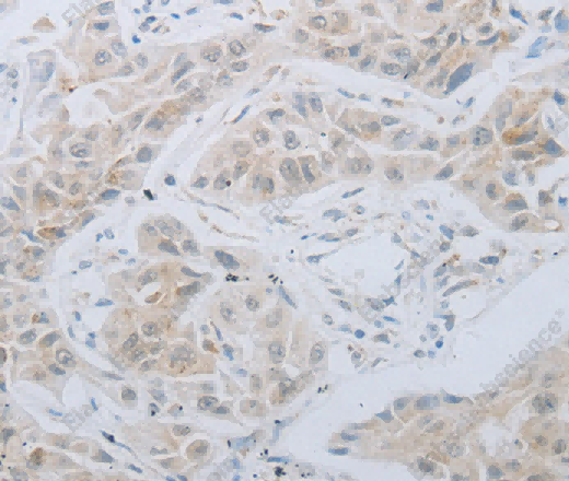 LOX Polyclonal Antibody - 2