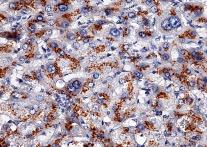 Recombinant Apolipoprotein H/APOH Monoclonal Antibody - 1