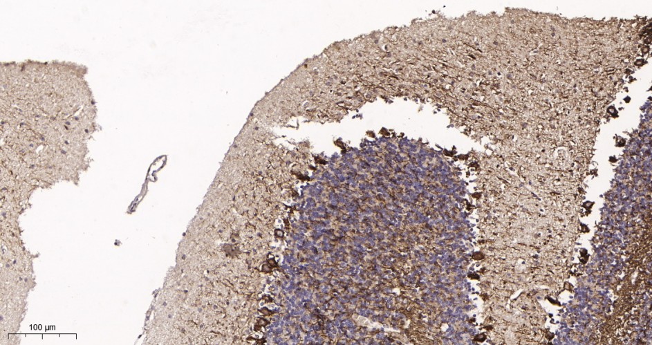 Recombinant Neurofilament heavy polypeptide Monoclonal Antibody - small - 3