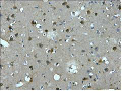 Immunohistochemistry of paraffin-embedded Human brain tissue using MAP2 Monoclonal Antibody at dilution of 1:200.