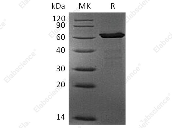 Recombinant Human FGL1 Protein (mFc Tag) - 1