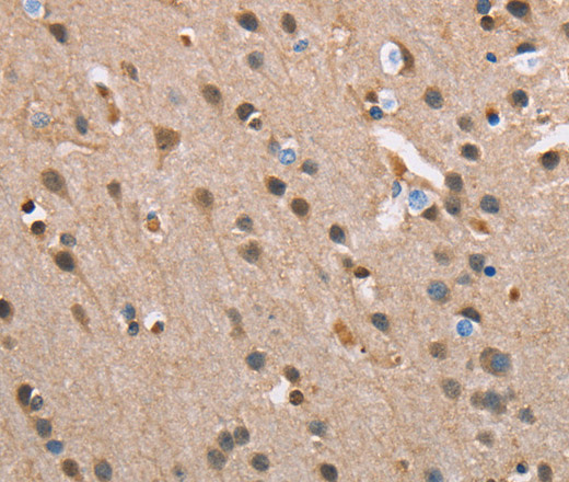 Immunohistochemistry of paraffin-embedded Human brain tissue using SERPINA1 Polyclonal Antibody at dilution 1:45