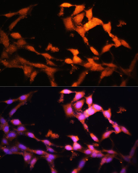 Immunofluorescence analysis of NIH/3T3 cells using FLCN Polyclonal Antibody at dilution of  1:100. Blue: DAPI for nuclear staining.