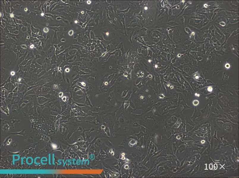 SK-GT-4 Cell Complete Medium - 1