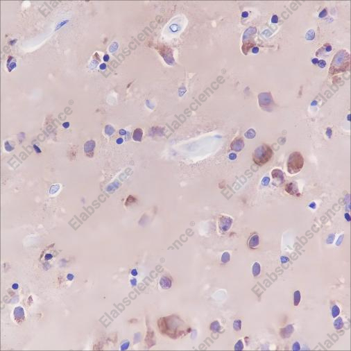 Recombinant GOT1 Monoclonal Antibody - 2