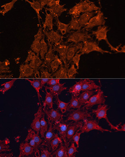 Immunofluorescence analysis of C6 cells using ADAM12 Polyclonal Antibody at dilution of  1:100. Blue: DAPI for nuclear staining.