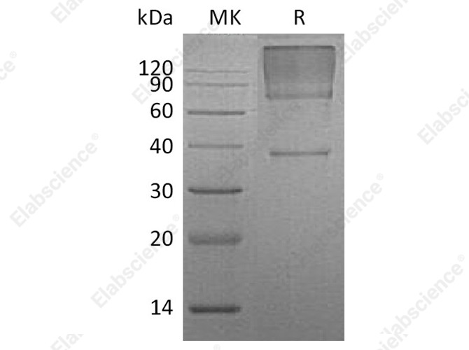 Recombinant Human Glypican 3/GPC3 Protein (His Tag) - 1