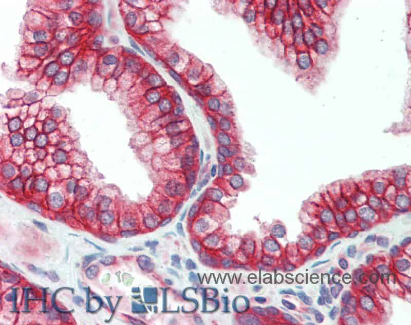 Immunohistochemistry of paraffin-embedded Prostate tissue using DSG2 Polyclonal Antibody at dilution of 1:150(Elabscience Product Detected by Lifespan).