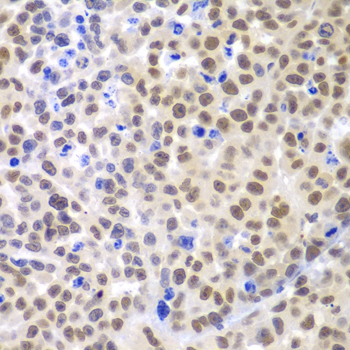 Immunohistochemistry of paraffin-embedded Mouse cancer using LHX4 Polyclonal Antibody at dilution of 1:100 (40x lens).