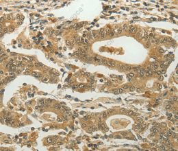 MYSM1 Polyclonal Antibody - 2