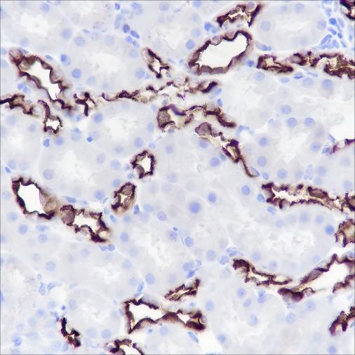 Recombinant MUC1 Monoclonal Antibody - small - 4