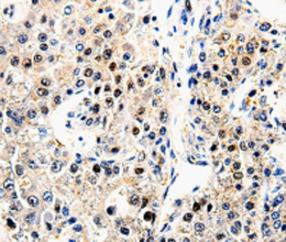 beta Amyloid Polyclonal Antibody - 2