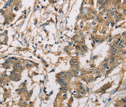 CBR1 Polyclonal Antibody - 3