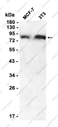 Recombinant Gelsolin Monoclonal Antibody - 1