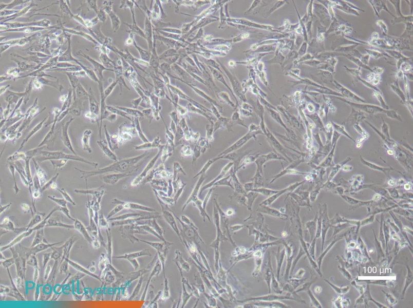 Human Umbilical Cord Mesenchymal Stem (Primary cell immortalization) Cell Complete MediumHuman Umbilical Cord Mesenchymal Stem (Primary cell immortalization) Cell Complete Medium - 3