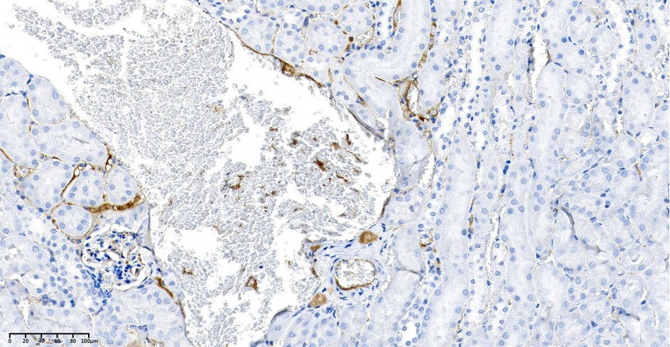 Recombinant LAMP2 Monoclonal Antibody - small - 3
