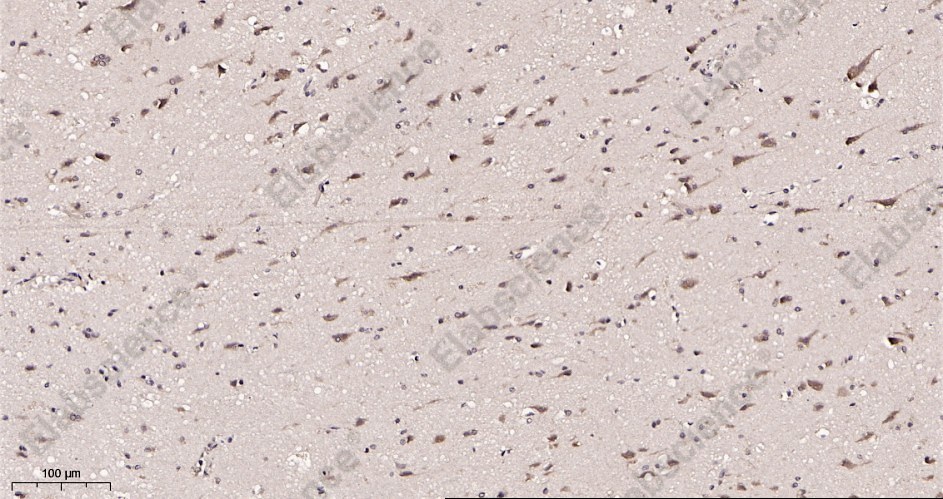Recombinant YTHDF1 Monoclonal Antibody - 2
