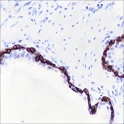 Recombinant Keratin 15 Monoclonal Antibody - small - 4