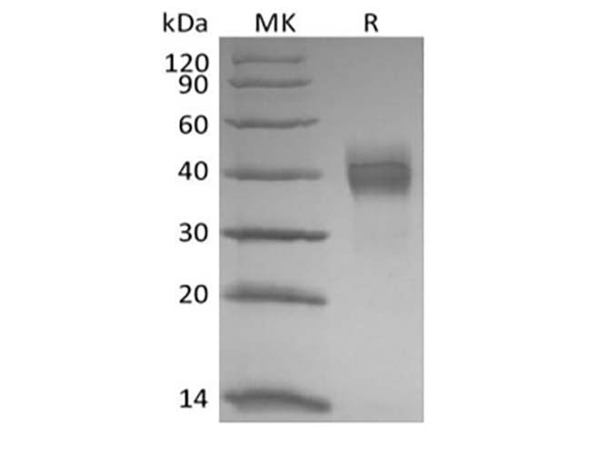 Immobilized Rhesus Macaque TROP-2-His(Cat#PKSQ050121) at 2ug/ml (100 ul/well) can bind Anti-Human TROP-2 mAb. The ED50 of Anti-Human TROP-2 mAb is 4. 7 ng/ml.