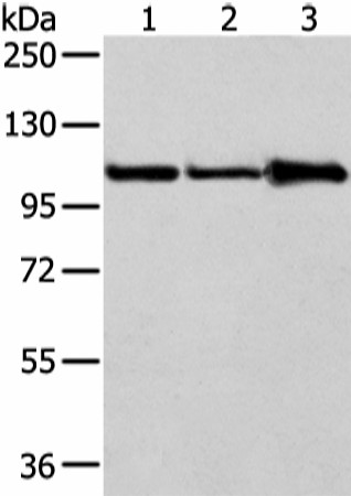 Western Blot analysis of A431, 231 and NIH/3T3 cell using AP2A1 Polyclonal Antibody at dilution of 1/250