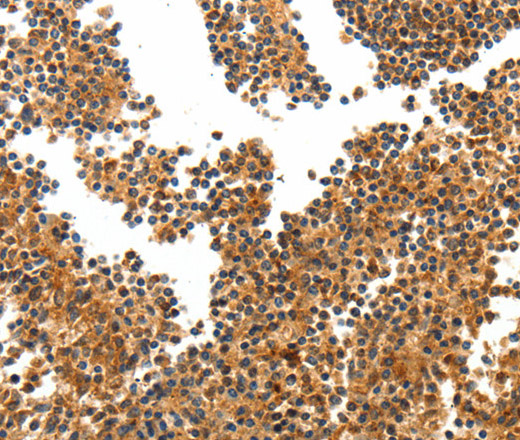 Immunohistochemistry of paraffin-embedded Human tonsil tissue using TERT Polyclonal Antibody at dilution 1:40