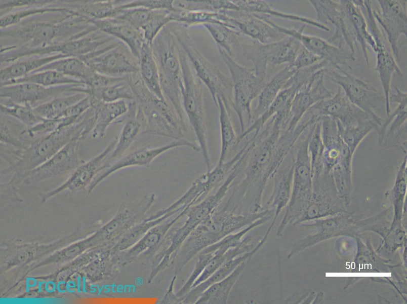 Human Oral Mucosal Fibroblast Complete Medium - small - 5