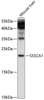 Western blot analysis of extracts of mouse liver using SSSCA1 Polyclonal Antibody at 1:1000 dilution.