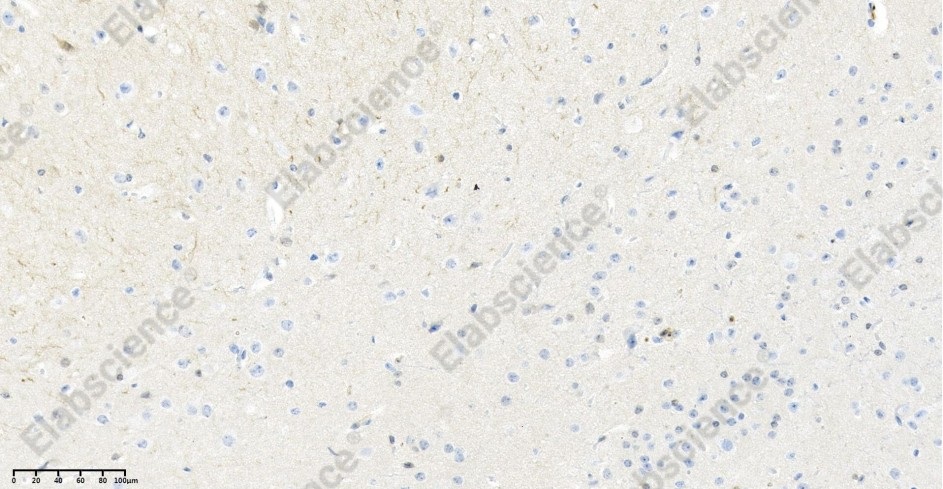 Recombinant Hsp70 Monoclonal Antibody - 4