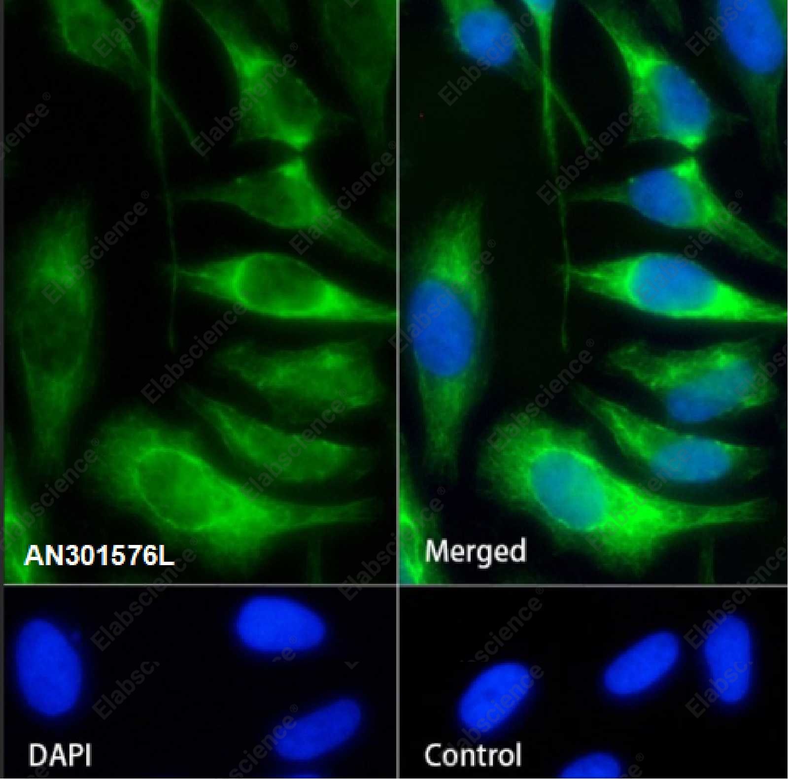 Recombinant Keratin 17 Monoclonal Antibody - 2
