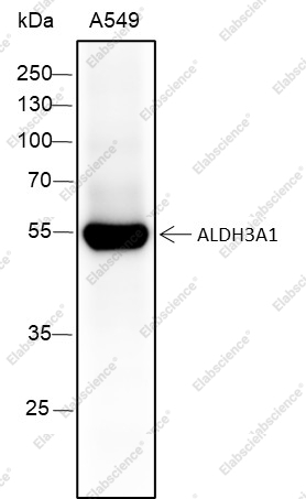 Recombinant ALDH3A1 Monoclonal Antibody - 1