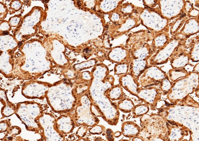 Recombinant S100P Monoclonal Antibody - small - 3
