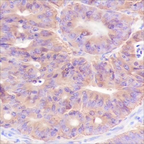 Recombinant Bid Monoclonal Antibody - 2